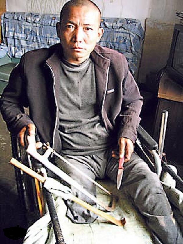 保定農民鄭艷良用鋼鋸和生果刀等幾樣簡陋工具,自己在家中「忍痛」截除右腿。