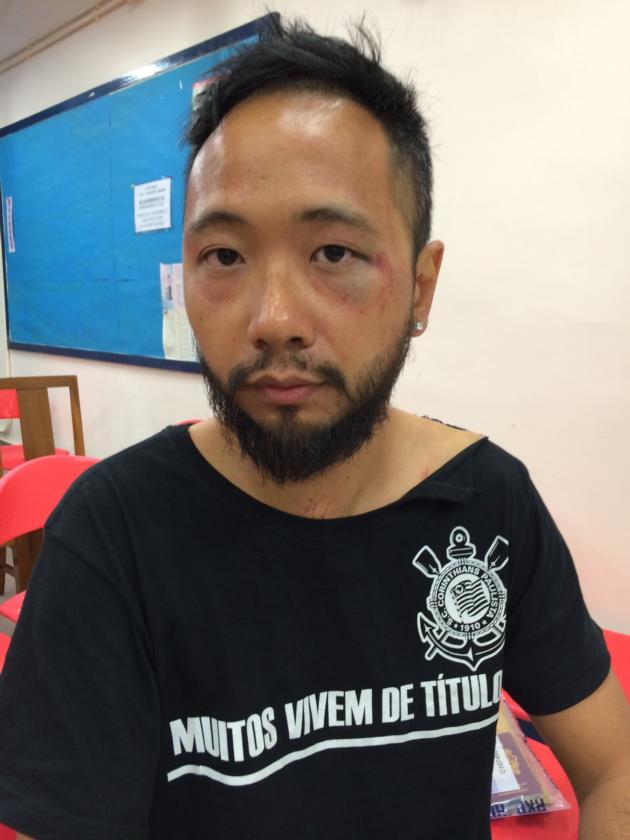 公民黨成員曾健超被警員群毆。