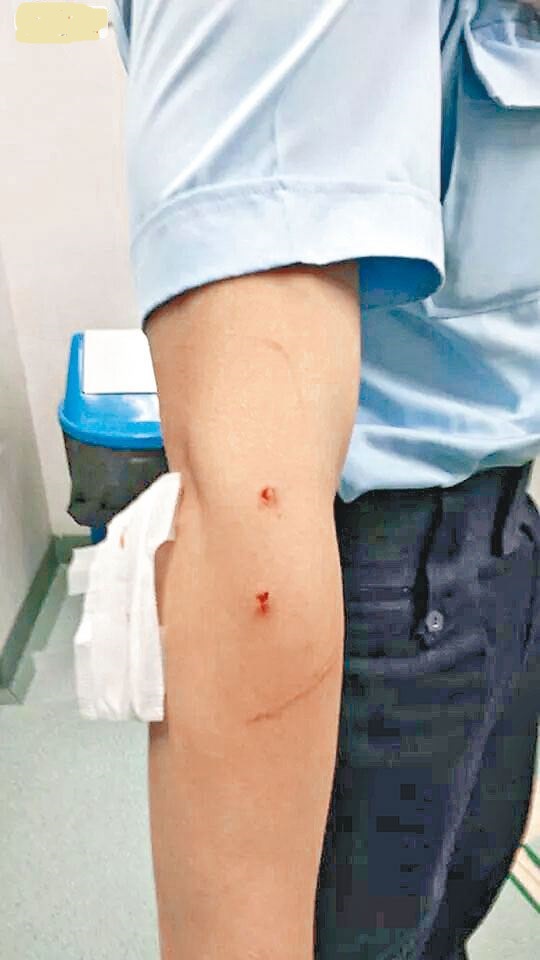 網上瘋傳一名警務人員的右手出現兩個「血孔」的照片。這表示什麼?自己不小心弄成的?想入示威者數?奇怪是為什麼不站出來講清楚?